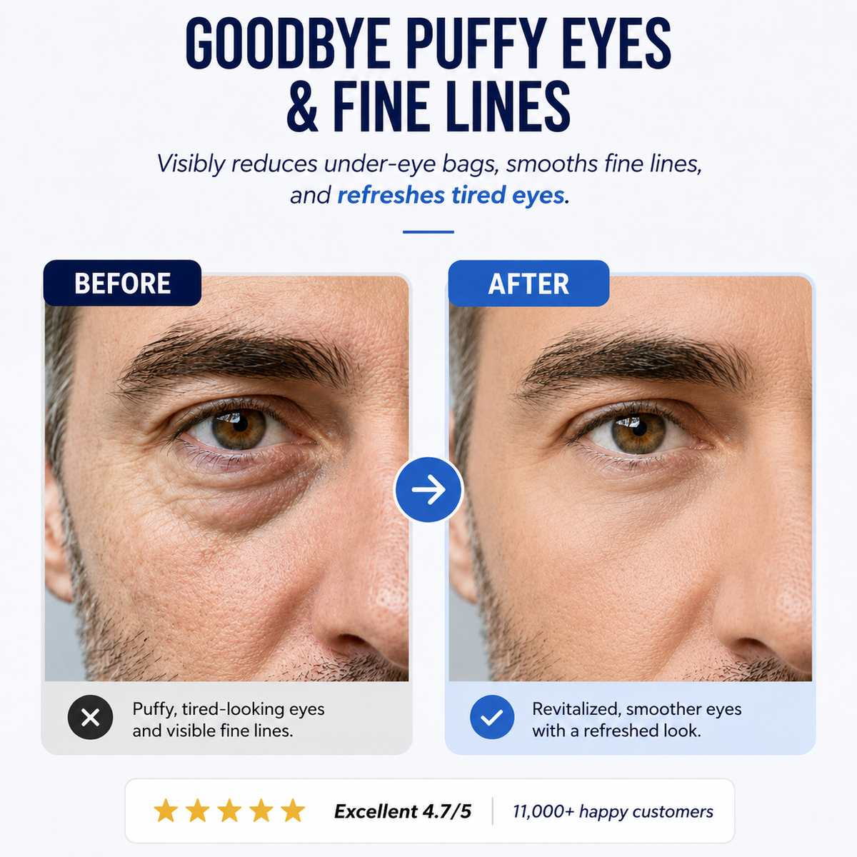 RESTED ™ Eye Patches for Men